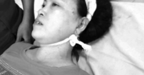 Khiếp vía trước gã chồng bất nhân treo thưởng "chặt tay", dọa giết cả nhà vợ