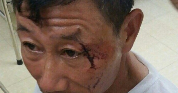 Phú Thọ: Cần sớm làm rõ vụ việc nhóm côn đồ “đại náo” vùng quê