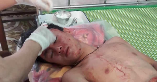 Khởi tố nhóm thanh niên lao xe máy vào trường học đánh thầy và trò nhập viện