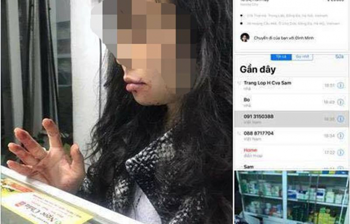 Nạn nh&acirc;n tr&igrave;nh b&aacute;o, sau khi vụ việc&nbsp;xảy ra chị bị rất nhiều số điện thoại lạ gọi điện, nhắn tin với mục đ&iacute;ch khủng bố tinh thần khiến chị rất mệt mỏi, &aacute;p lực.