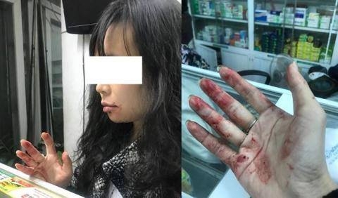 Điều tra làm rõ vụ tài xế Uber đánh "bầm mặt" khách hàng