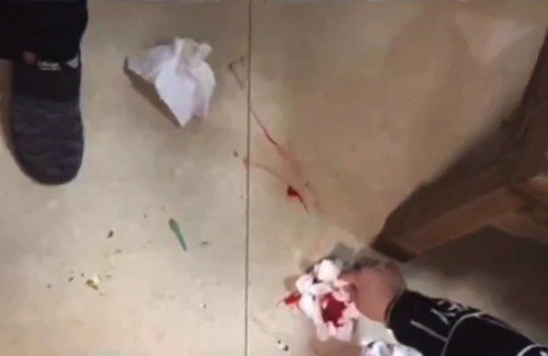 Đến rước d&acirc;u, ch&uacute; rể cầm b&uacute;a đập cửa khiến d&agrave;n ph&ugrave; d&acirc;u bị thương nặng