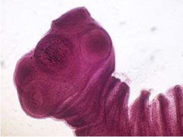 Đầu s&aacute;n dải heo (s&aacute;n d&acirc;y lợn).