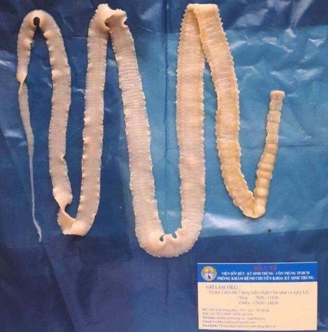 Mẫu s&aacute;n d&acirc;y thu hồi tại Ph&ograve;ng kh&aacute;m bệnh Chuy&ecirc;n khoa K&yacute; sinh tr&ugrave;ng,&nbsp;  Viện Sốt r&eacute;t - K&yacute; sinh tr&ugrave;ng - C&ocirc;n tr&ugrave;ng TP. HCM.