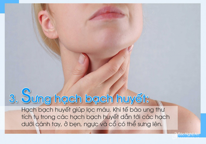 8 dấu hiệu ph&aacute;t hiện sớm bệnh ung thư m&aacute;u