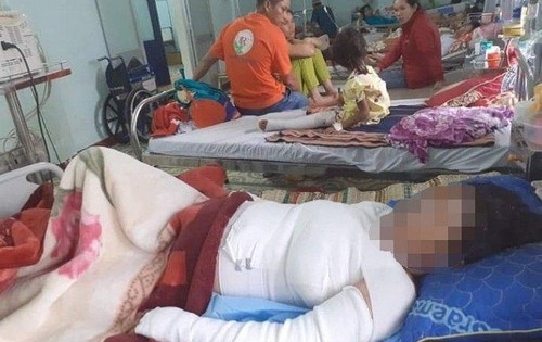 Sản phụ mang thai 37 tuần tuổi đổ xăng tự thiêu sau cuộc cãi nhau với chồng