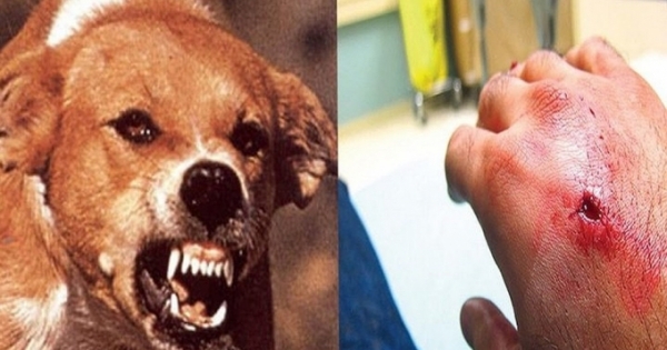 Cụ bà tử vong vì lên cơn dại sau khi bị chó hàng xóm cắn