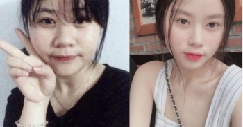 Giảm gần 30kg trong 3 tháng, nữ sinh phủ nhận “lột xác” nhờ dao kéo