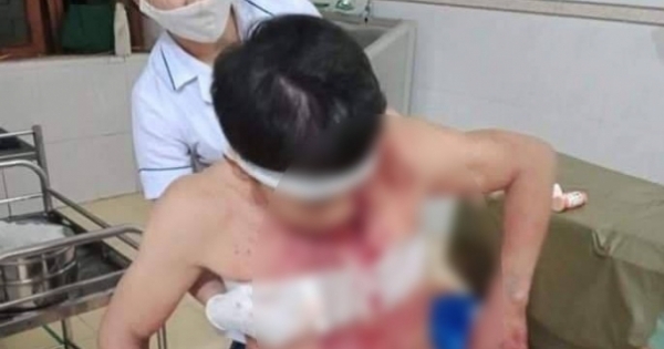 Gia chủ bị chém trọng thương ngay tại nhà của mình