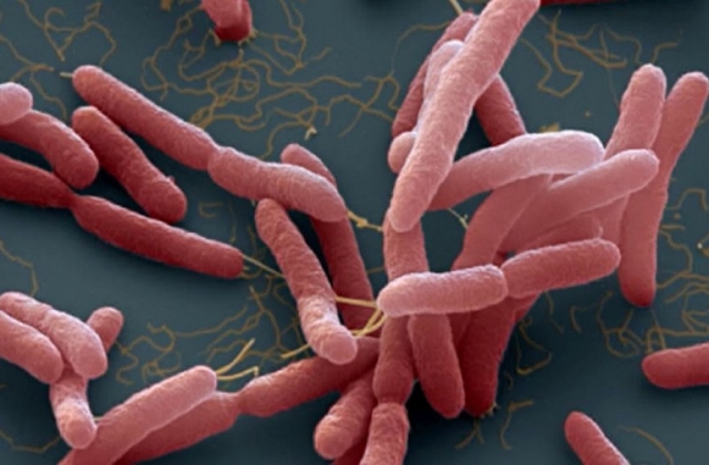 Ph&aacute;t hiện 3 ca mắc Whitmore tại Thanh H&oacute;a, Đắk Lắk, Bộ Y tế ra c&ocirc;ng văn khẩn