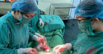 Hy hữu: Sản phụ mang thai đôi ở hai tử cung khác nhau