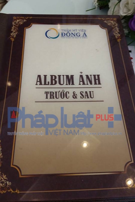 Album c&oacute; những h&igrave;nh ảnh phẫu thuật n&acirc;ng ngực, m&ocirc;ng, đ&ugrave;i, h&uacute;t mỡ bụng của Thẩm mỹ viện Đ&ocirc;ng &Aacute;.