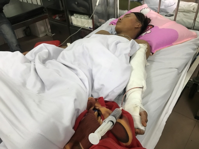 Anh Vương bị ch&eacute;m gần dứt l&igrave;a c&aacute;nh tay tr&aacute;i.