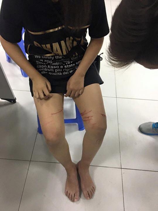 C&ocirc; g&aacute;i bị