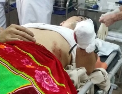 Hiện tại anh Ngọc vẫn đang tiếp tục được theo d&otilde;i tại bệnh viện.