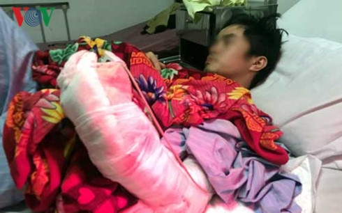 Hiện b&agrave;n tay của anh L&ecirc; Văn Ngọc đ&atilde; được gh&eacute;p thanh c&ocirc;ng, hồng ấm v&agrave; c&oacute; dấu hiệu hồi phục trở lại.