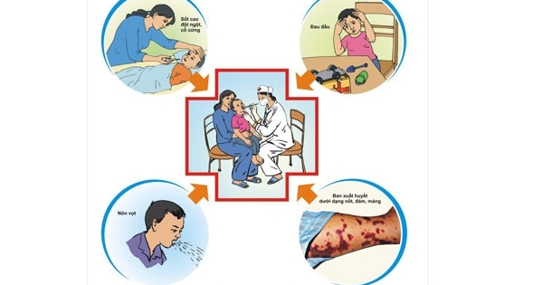 Cảnh báo căn bệnh nguy hiểm viêm não mô cầu tại Hà Nội