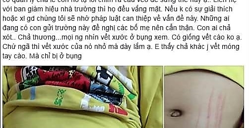 Một bé trai bị tổn thương vùng kín ở Sơn La: Lỗi không phải do cô giáo!