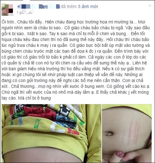 Facebooker H. T. K. T. đ&atilde; đăng tải nội dung trạng th&aacute;i tr&ecirc;n mạng x&atilde; hội trước đ&oacute;, việc một b&eacute; trai bị tổn thương v&ugrave;ng k&iacute;n sau khi đi học về.