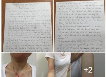 Xôn xao chuyện người phụ nữ bị hành hung trong thang máy vì nhắc khạc nhổ bậy