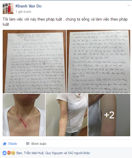 Những h&igrave;nh ảnh vết thương tr&ecirc;n cơ thể k&egrave;m theo l&aacute; đơn tố c&aacute;o được chị V&acirc;n chia sẻ l&ecirc;n mạng x&atilde; hội.