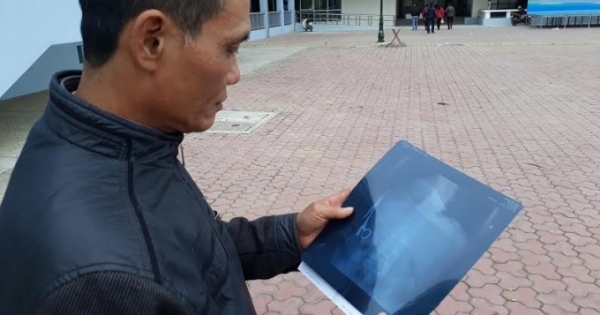 Vụ "quên kéo" trong bụng bệnh nhân 18 năm: Nếu ở thời điểm này thì rất nghiêm trọng