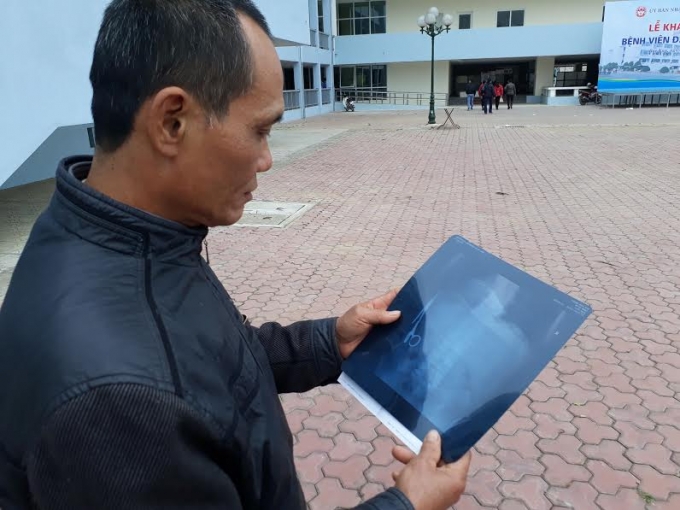 &Ocirc;ng Nhật vẫn chưa hết b&agrave;ng ho&agrave;ng khi ph&aacute;t hiện ra sự việc.