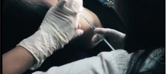 Chất làm đầy thẩm mỹ filter - Làm đẹp hay gây họa?