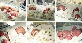 Hy hữu ca mang thai 6 thành công
