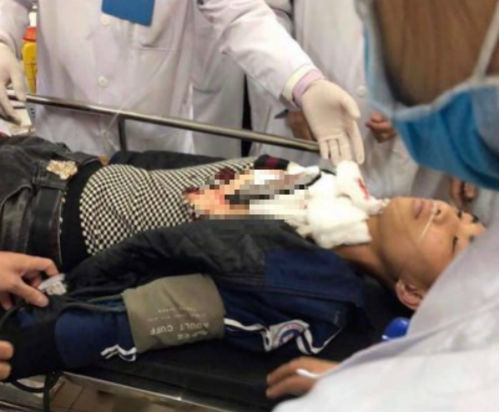 Nạn nh&acirc;n được đưa v&agrave;o bệnh viện Đa khoa tỉnh Hải Dương cấp cứu.