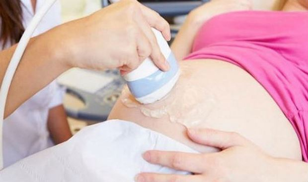 H&igrave;nh minh họa.