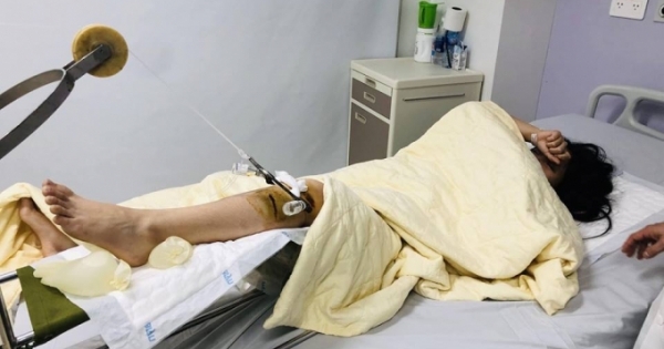 Đã bắt được tài xế Range Rover đâm gãy chân nữ sinh viên Đại học rồi bỏ chạy