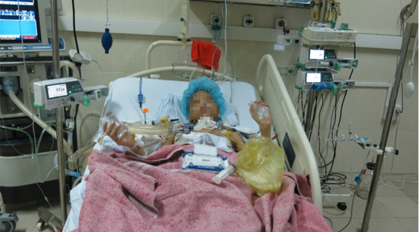 Thanh ni&ecirc;n 17 tuổi bị ung thư phổi được gh&eacute;p c&ugrave;ng l&uacute;c 2 l&aacute; phổi