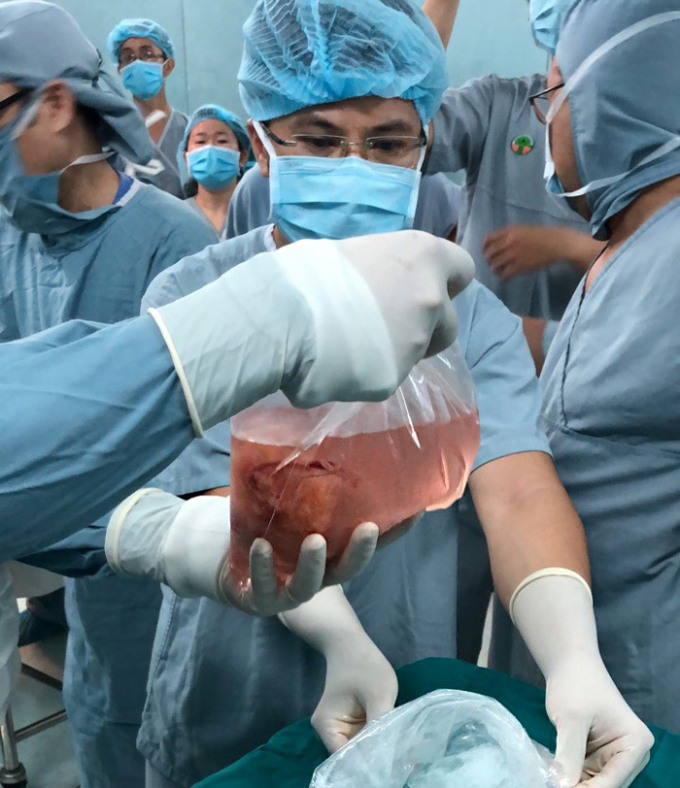 Quả thận được vận chuyển từ H&agrave; Nội v&agrave;o TP.HCM được bảo quản an to&agrave;n cho đến l&uacute;c gh&eacute;p cho bệnh nh&acirc;n. Ảnh: BVCC