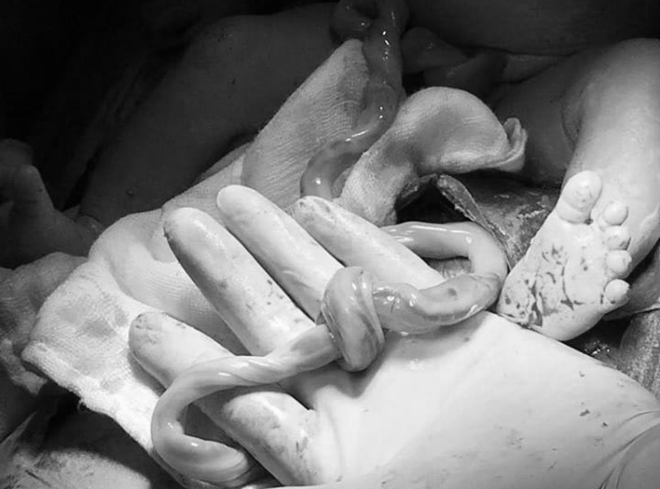 B&aacute;c sĩ bỏ ngang ca kh&aacute;m bệnh, lao v&agrave;o ph&ograve;ng mổ cứu b&eacute; sơ sinh