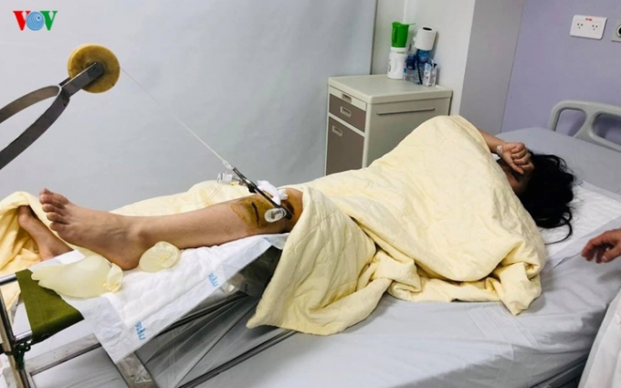 Nạn nh&acirc;n Trần L&ecirc; Minh Trang. Ảnh của VOV