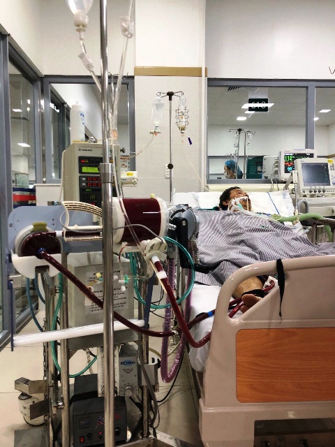 Bệnh nh&acirc;n phải d&ugrave;ng hệ tuần ho&agrave;n nh&acirc;n tạo&nbsp;ECMO tại Khoa hồi sức t&iacute;ch cực Bệnh viện Bạch Mai. Ảnh:&nbsp;Bệnh viện cung cấp.