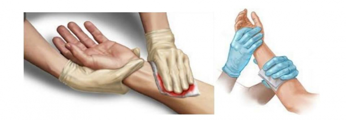 Cần biết sơ cứu đ&uacute;ng c&aacute;ch.