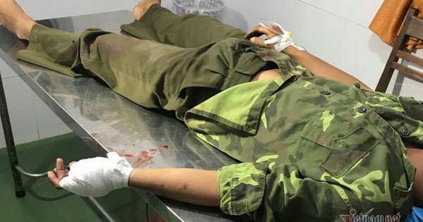 Bị phát hiện cắt trộm gỗ, hơn 20 lâm tặc vây chém đứt gân tay kiểm lâm