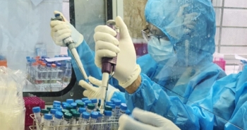 Đã lấy mẫu xét nghiệm 2.244 người liên quan đến ca Covid-19 tại TP Hồ Chí Minh