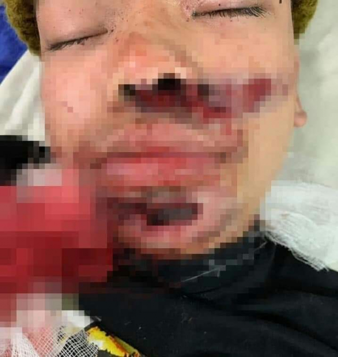 z22347020136997cbd4fa366bfbc2401cc949d1bca7d4d-1608295203223468987940