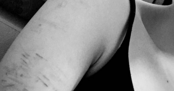 Giật mình người trẻ rạch tay, uống thuốc ngủ... trong mùa Giáng sinh