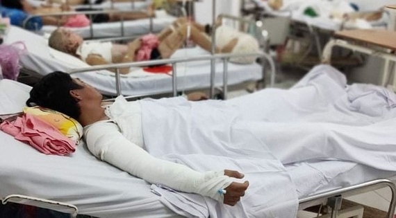 Xì hơi chảo lọc dầu khiến 7 công nhân bị bỏng nặng